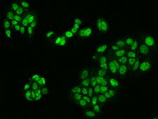 LUC7L2 Antibody - Immunofluorescence staining of LUC7L2 in MCF7 cells. Cells were fixed with 4% PFA, permeabilzed with 0.3% Triton X-100 in PBS, blocked with 10% serum, and incubated with rabbit anti-Human LUC7L2 polyclonal antibody (dilution ratio 1:200) at 4°C overnight. Then cells were stained with the Alexa Fluor 488-conjugated Goat Anti-rabbit IgG secondary antibody (green). Positive staining was localized to Nucleus.