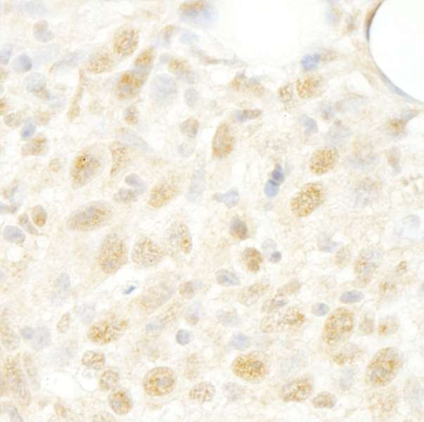 LUC7L3 / CROP Antibody - Detection of Mouse CROP/Luc7A by Immunohistochemistry. Sample: FFPE section of mouse colon carcinoma CT26. Antibody: Affinity purified rabbit anti-CROP/Luc7A used at a dilution of 1:250.