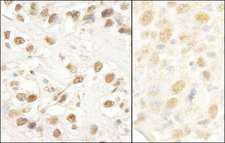 LUC7L3 / CROP Antibody - Detection of Human and Mouse CROP/Luc7A by Immunohistochemistry. Sample: FFPE section of human testicular seminoma (left) and mouse colon carcinoma (right). Antibody: Affinity purified rabbit anti-CROP/Luc7A used at a dilution of 1:1000 (1 ug/ml). Detection: DAB.