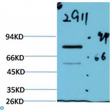 Luciferase Antibody - Western Blot (WB) analysis of Firefly Luciferase Transfected HeLa Cell Lysate using Luciferase Mouse Monoclonal Antibody diluted at 1:2000.