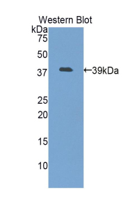 Lumican Antibody - Western blot of recombinant Lumican.  This image was taken for the unconjugated form of this product. Other forms have not been tested.