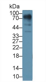 Lumican Antibody - Western Blot; Sample: Human Lung lysate; Primary Ab: 1µg/ml Rabbit Anti-Human LUM Antibody Second Ab: 0.2µg/mL HRP-Linked Caprine Anti-Rabbit IgG Polyclonal Antibody