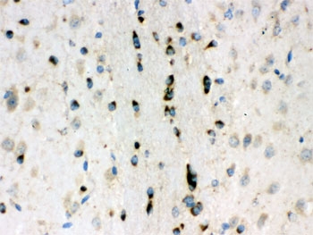 Lumican Antibody