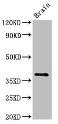 Lumican Antibody - Western Blot Positive WB detected in: Rat brain tissue All lanes: Lum antibody at 2.5µg/ml Secondary Goat polyclonal to rabbit IgG at 1/50000 dilution Predicted band size: 39 kDa Observed band size: 39 kDa