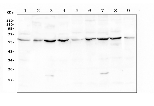 Lumican Antibody - Western blot analysis of Lumican using anti-Lumican antibody. Electrophoresis was performed on a 5-20% SDS-PAGE gel at 70V (Stacking gel) / 90V (Resolving gel) for 2-3 hours. The sample well of each lane was loaded with 50ug of sample under reducing conditions. Lane 1: mouse liver tissue lysates,Lane 2: mouse ovary tissue lysates,Lane 3: mouse testis tissue lysates,Lane 4: mouse lung tissue lysates,Lane 5: rat liver tissue lysates,Lane 6: rat ovary tissue lysates,Lane 7: rat testis tissue lysates,Lane 8: rat lung tissue lysates,Lane 9: rat heart tissue lysates. After Electrophoresis, proteins were transferred to a Nitrocellulose membrane at 150mA for 50-90 minutes. Blocked the membrane with 5% Non-fat Milk/ TBS for 1.5 hour at RT. The membrane was incubated with rabbit anti-Lumican antigen affinity purified polyclonal antibody at 0.5 µg/mL overnight at 4°C, then washed with TBS-0.1% Tween 3 times with 5 minutes each and probed with a goat anti-rabbit IgG-HRP secondary antibody at a dilution of 1:10000 for 1.5 hour at RT. The signal is developed using an Enhanced Chemiluminescent detection (ECL) kit with Tanon 5200 system. A specific band was detected for Lumican at approximately 58KD. The expected band size for Lumican is at 38KD.