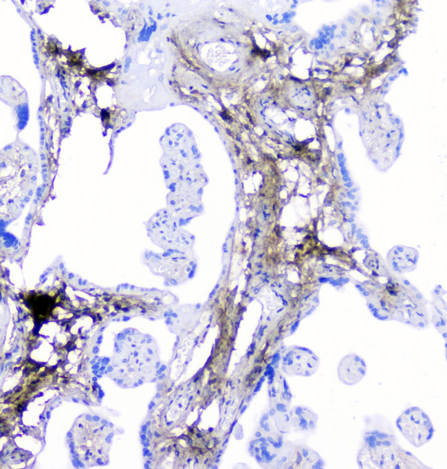 Lumican Antibody - IHC analysis of Lumican using anti-Lumican antibody. Lumican was detected in paraffin-embedded section of human placenta tissue. Heat mediated antigen retrieval was performed in citrate buffer (pH6, epitope retrieval solution) for 20 mins. The tissue section was blocked with 10% goat serum. The tissue section was then incubated with 1µg/ml rabbit anti-Lumican Antibody overnight at 4°C. Biotinylated goat anti-rabbit IgG was used as secondary antibody and incubated for 30 minutes at 37°C. The tissue section was developed using Strepavidin-Biotin-Complex (SABC) with DAB as the chromogen.