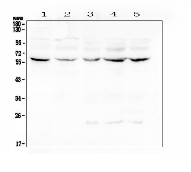 Lumican Antibody - Western blot analysis of Lumican using anti-Lumican antibody. Electrophoresis was performed on a 5-20% SDS-PAGE gel at 70V (Stacking gel) / 90V (Resolving gel) for 2-3 hours. The sample well of each lane was loaded with 50ug of sample under reducing conditions. Lane 1: human placenta tissue lysates,Lane 2: human Caco-2 whole cell lysate,Lane 3: human CCRF-CEM whole cell lysate,Lane 4: human Hela whole cell lysate,Lane 5: human Jurkat whole cell lysate. After Electrophoresis, proteins were transferred to a Nitrocellulose membrane at 150mA for 50-90 minutes. Blocked the membrane with 5% Non-fat Milk/ TBS for 1.5 hour at RT. The membrane was incubated with rabbit anti-Lumican antigen affinity purified polyclonal antibody at 0.5 µg/mL overnight at 4°C, then washed with TBS-0.1% Tween 3 times with 5 minutes each and probed with a goat anti-rabbit IgG-HRP secondary antibody at a dilution of 1:10000 for 1.5 hour at RT. The signal is developed using an Enhanced Chemiluminescent detection (ECL) kit with Tanon 5200 system. A specific band was detected for Lumican at approximately 58KD. The expected band size for Lumican is at 38KD.