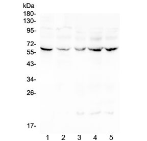 Lumican Antibody - Western blot testing of human 1) placenta, 2) Caco-2, 3) CCRF-CEM, 4) HeLa and 5) Jurkat lysate with LUM antibody at 0.5ug/ml. Expected moleculer weight: ~40 kDa (unmodified), ~60 kDa (glycosylated).