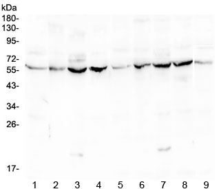 Lumican Antibody - Western blot testing of mouse 1) liver, 2) ovary, 3) testis, 4) lung and rat 5) liver, 6) ovary, 7) testis, 8) lung and 9) heart lysate with LUM antibody at 0.5ug/ml. Expected moleculer weight: ~40 kDa (unmodified), ~60 kDa (glycosylated).