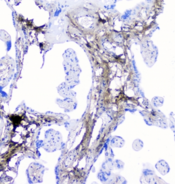 Lumican Antibody - IHC staining of FFPE human placenta with LUM antibody at 1ug/ml. HIER: boil tissue sections in pH6, 10mM citrate buffer, for 10-20 min followed by cooling at RT for 20 min.