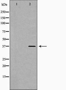 Lumican Antibody - Western blot analysis of HeLa whole cells lysates using LUM antibody. The lane on the left is treated with the antigen-specific peptide.