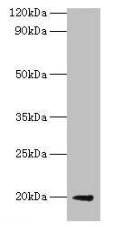 luxS Antibody - Western blot All lanes: S-ribosylhomocysteine lyase antibody at 2µg/ml + DH5a whole cell lysate Secondary Goat polyclonal to rabbit IgG at 1/10000 dilution Predicted band size: 19 kDa Observed band size: 19 kDa