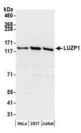 LUZP1 Antibody - Detection of human LUZP1 by western blot. Samples: Whole cell lysate (50 µg) from HeLa, HEK293T, and Jurkat cells prepared using NETN lysis buffer. Antibodies: Affinity purified rabbit anti-LUZP1 antibody used for WB at 0.4 µg/ml. Detection: Chemiluminescence with an exposure time of 30 seconds.