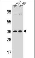 LUZP2 Antibody - LUZP2 Antibody western blot of ZR-75-1,HL-60 cell line lysates (35 ug/lane). The LUZP2 antibody detected the LUZP2 protein (arrow).