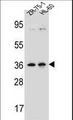 LUZP2 Antibody - LUZP2 Antibody western blot of ZR-75-1,HL-60 cell line lysates (35 ug/lane). The LUZP2 antibody detected the LUZP2 protein (arrow).