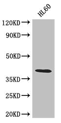 LUZP2 Antibody - Western Blot Positive WB detected in: HL6 whole cell lysate All lanes: LUZP2 antibody at 2.6µg/ml Secondary Goat polyclonal to rabbit IgG at 1/50000 dilution Predicted band size: 39, 19, 16, 29 kDa Observed band size: 39 kDa