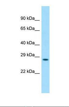 LUZP4 Antibody - Western blot of Human 293T. LUZP4 antibody dilution 1.0 ug/ml.  This image was taken for the unconjugated form of this product. Other forms have not been tested.