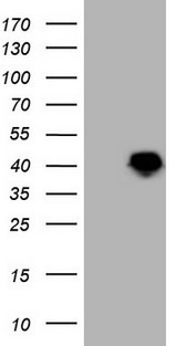LUZP4 Antibody - HEK293T cells were transfected with the pCMV6-ENTRY control. (Left lane) or pCMV6-ENTRY LUZP4. (Right lane) cDNA for 48 hrs and lysed. Equivalent amounts of cell lysates. (5 ug per lane) were separated by SDS-PAGE and immunoblotted with anti-LUZP4. (1:2000)