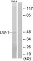 LW-1 / HSFX1 Antibody - Western blot analysis of lysates from HeLa cells, using LW-1 Antibody. The lane on the right is blocked with the synthesized peptide.