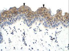 LW-1 / HSFX1 Antibody - HSFX1 / LW-1 antibody ARP35905_P050-NP_057237-LW-1 Antibody was used in IHC to stain formalin-fixed, paraffin-embedded human skin.  This image was taken for the unconjugated form of this product. Other forms have not been tested.