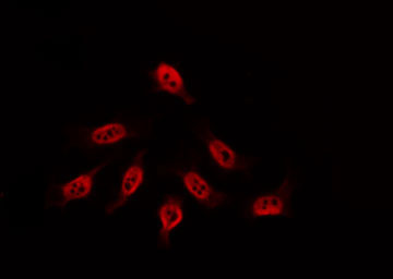 LW-1 / HSFX1 Antibody - Staining HeLa cells by IF/ICC. The samples were fixed with PFA and permeabilized in 0.1% Triton X-100, then blocked in 10% serum for 45 min at 25°C. The primary antibody was diluted at 1:200 and incubated with the sample for 1 hour at 37°C. An Alexa Fluor 594 conjugated goat anti-rabbit IgG (H+L) Ab, diluted at 1/600, was used as the secondary antibody.