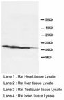 Ly6a / Sca-1 Antibody -  This image was taken for the unconjugated form of this product. Other forms have not been tested.