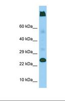 LY6G5C Antibody - Western blot of Human U937. LY6G5C antibody dilution 1.0 ug/ml.  This image was taken for the unconjugated form of this product. Other forms have not been tested.