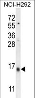 LY6G6C Antibody - LY6G6C Antibody western blot of NCI-H292 cell line lysates (35 ug/lane). The LY6G6C antibody detected the LY6G6C protein (arrow).