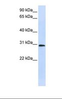 LY6G6F Antibody - Placenta lysate. Antibody concentration: 1.0 ug/ml. Gel concentration: 12%.  This image was taken for the unconjugated form of this product. Other forms have not been tested.