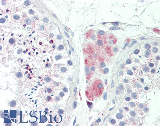 LY6G6F Antibody - Anti-LY6G6F antibody IHC staining of human testis. Immunohistochemistry of formalin-fixed, paraffin-embedded tissue after heat-induced antigen retrieval. Antibody concentration 10 ug/ml.  This image was taken for the unconjugated form of this product. Other forms have not been tested.