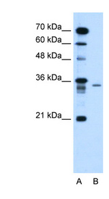 LY6G6F Antibody - LY6G6F antibody Western blot of HepG2 cell lysate.  This image was taken for the unconjugated form of this product. Other forms have not been tested.