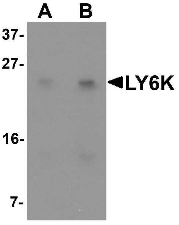 LY6K Antibody - Western blot analysis of LY6K in HeLa cell lysate with LY6K antibody at (A) 1 and (B) 2 ug/ml.