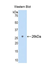 LY9 / CD229 Antibody - Western blot of recombinant LY9 / CD229.  This image was taken for the unconjugated form of this product. Other forms have not been tested.
