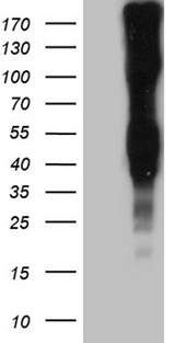 LY9 / CD229 Antibody - HEK293T cells were transfected with the pCMV6-ENTRY control. (Left lane) or pCMV6-ENTRY. (Right lane) cDNA for 48 hrs and lysed