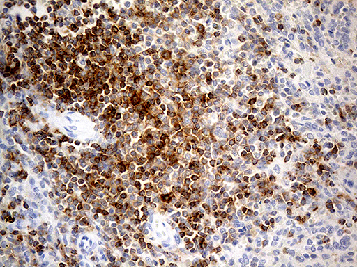 LY9 / CD229 Antibody - Immunohistochemical staining of paraffin-embedded Human spleen tissue within the normal limits using anti-LY9 mouse monoclonal antibody. (Heat-induced epitope retrieval by 1mM EDTA in 10mM Tris buffer. (pH8.5) at 120°C for 3 min. (1:500)