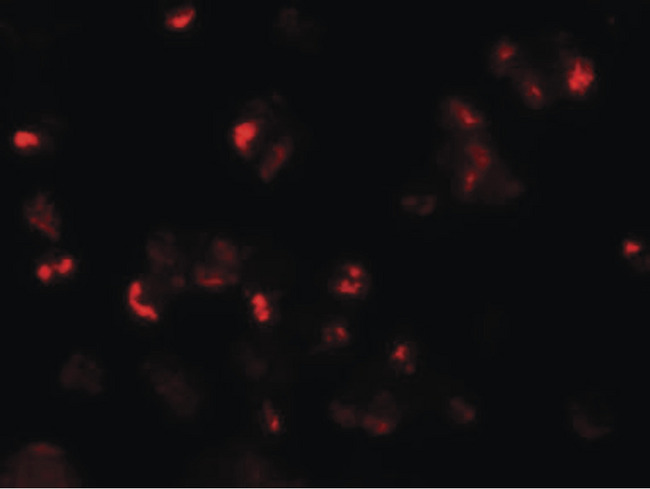 LY9 / CD229 Antibody - Immunofluorescence of SLAMF3 in 293 cells with SLAMF3 antibody at 20 ug/ml.