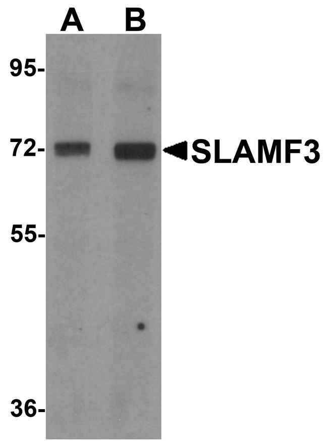 LY9 / CD229 Antibody - Western blot analysis of SLAMF3 in 293 cell lysate with SLAMF3 antibody at (A) 1 and (B) 2 ug/ml.