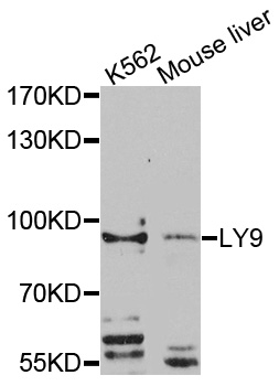 LY9 / CD229 Antibody - Western blot analysis of extracts of various cell lines, using LY9 antibody at 1:1000 dilution. The secondary antibody used was an HRP Goat Anti-Rabbit IgG (H+L) at 1:10000 dilution. Lysates were loaded 25ug per lane and 3% nonfat dry milk in TBST was used for blocking. An ECL Kit was used for detection and the exposure time was 90s.
