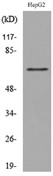 LY9 / CD229 Antibody - Western blot analysis of lysate from HepG2 cells, using LY9 Antibody.
