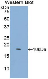 LY96 / MD2 / MD-2 Antibody - Western blot of recombinant LY96 / MD2 / MD-2.  This image was taken for the unconjugated form of this product. Other forms have not been tested.