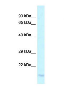 LY96 / MD2 / MD-2 Antibody - LY96 / MD-2 antibody Western blot of PANC1 Cell lysate. Antibody concentration 1 ug/ml.  This image was taken for the unconjugated form of this product. Other forms have not been tested.