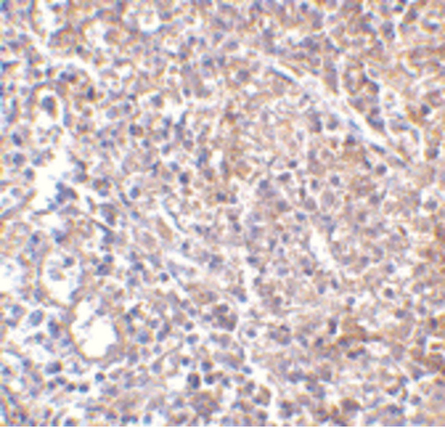 LY96 / MD2 / MD-2 Antibody - Immunohistochemistry of MD-2 in human spleen with MD-2 antibody at 2.5 ug/ml.