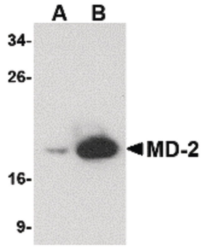 LY96 / MD2 / MD-2 Antibody - Western blot of (A) 25 and (B) 125 ng of MD-2 recombinant protein with MD-2 antibody at 1 ug/ml.