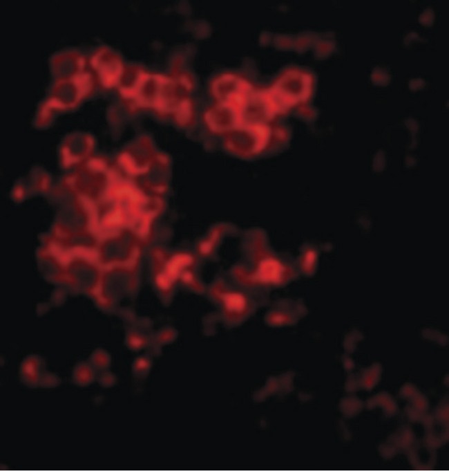 LY96 / MD2 / MD-2 Antibody - Immunofluorescence of MD-2 in Rat Spleen cells with MD-2 antibody at 10 ug/ml.