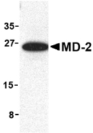 LY96 / MD2 / MD-2 Antibody - Western blot of MD-2 in mouse spleen cell lysate with MD-2 antibody at 1 ug/ml.