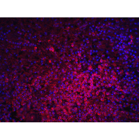 LY96 / MD2 / MD-2 Antibody - Immunofluorescence of MD-2 in human spleen tissue with MD 2 antibody at 20 µg/mL.Red: MD-2 Antibody  Blue: DAPI staining