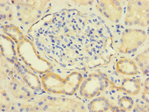 LY96 / MD2 / MD-2 Antibody - Immunohistochemistry of paraffin-embedded human kidney tissue using LY96 Antibody at dilution of 1:100