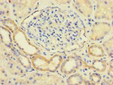 LY96 / MD2 / MD-2 Antibody - Immunohistochemistry of paraffin-embedded human kidney tissue using LY96 Antibody at dilution of 1:100