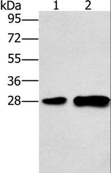 LY96 / MD2 / MD-2 Antibody - Western blot analysis of Mouse liver tissue and 231 cell, using LY96 Polyclonal Antibody at dilution of 1:500.