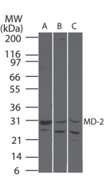 LY96 / MD2 / MD-2 Antibody - Western blot of MD-2 in A) human, B) mouse, and C) rat spleen lysate using antibody at 2 ug/ml.